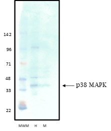 p38 MAPK Western Blot Data