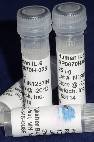Human IL-6 (Yeast-derived Recombinant Protein) - 500 ug (5 x 100 ug vials)