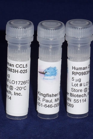 Human CCL5 (RANTES) (Yeast-derived Recombinant Protein) - 5 micrograms